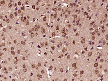 KATNAL2 Rabbit Polyclonal Antibody