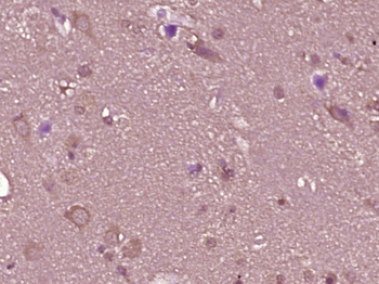KAZALD1 Rabbit Polyclonal Antibody
