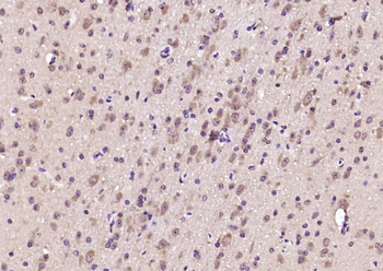 KBTBD11 Rabbit Polyclonal Antibody