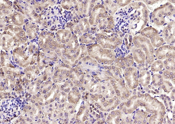 KBTBD11 Rabbit Polyclonal Antibody