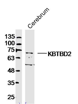 KBTBD2 Rabbit Polyclonal Antibody