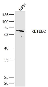 KBTBD2 Rabbit Polyclonal Antibody