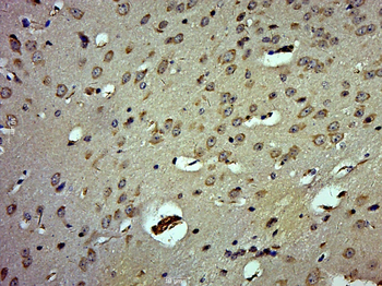 KBTBD7 Rabbit Polyclonal Antibody