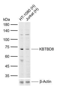 KBTBD8 Rabbit Polyclonal Antibody