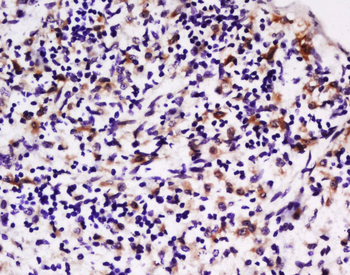 LPA2 Rabbit Polyclonal Antibody