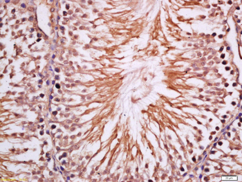 LXR alpha Rabbit Polyclonal Antibody