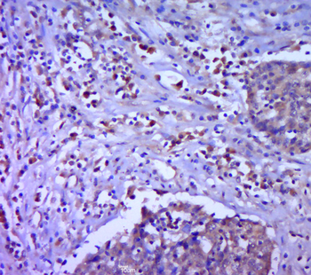 LITD1 Rabbit Polyclonal Antibody