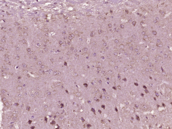 L2HGDH Rabbit Polyclonal Antibody