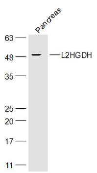 L2HGDH Rabbit Polyclonal Antibody