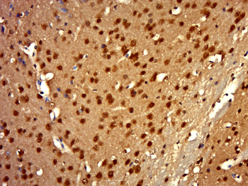 L3MBTL2 Rabbit Polyclonal Antibody