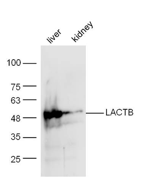 LACTB Rabbit Polyclonal Antibody