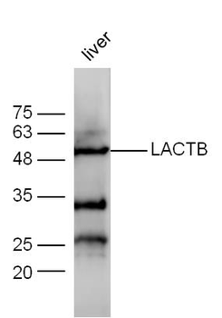 LACTB Rabbit Polyclonal Antibody