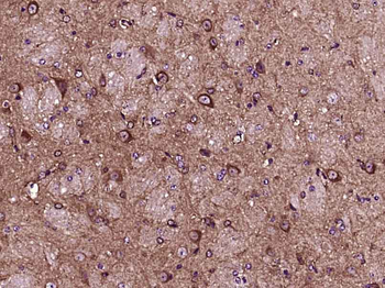 LARP1 Rabbit Polyclonal Antibody
