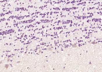 LAT2 Rabbit Polyclonal Antibody