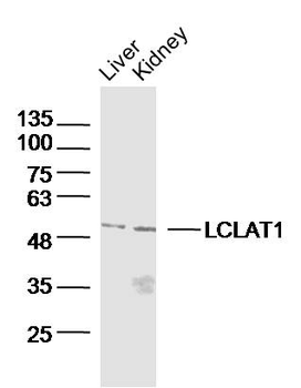 LCLAT1 Rabbit Polyclonal Antibody