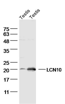 LCN10 Rabbit Polyclonal Antibody