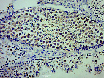 LCN8 Rabbit Polyclonal Antibody