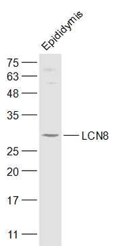 LCN8 Rabbit Polyclonal Antibody