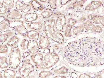 LDB2 Rabbit Polyclonal Antibody