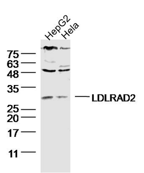 LDLRAD2 Rabbit Polyclonal Antibody
