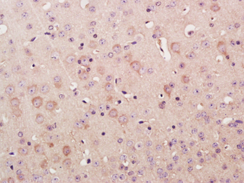 Leucyl tRNA synthetase Rabbit Polyclonal Antibody