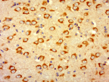 LHFPL5 Rabbit Polyclonal Antibody
