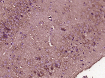 LIAS Rabbit Polyclonal Antibody