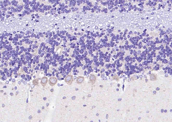 Phospho-LIM Kinase 1 (Thr508) Rabbit Polyclonal Antibody