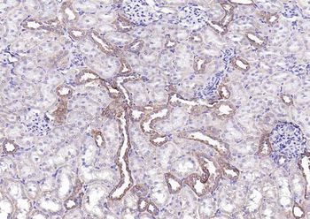 Phospho-LIM Kinase 1 (Thr508) Rabbit Polyclonal Antibody