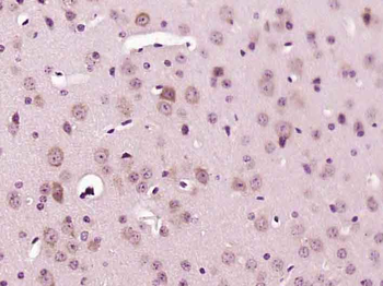 LIMCH1 Rabbit Polyclonal Antibody