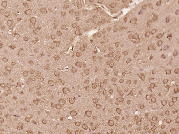 LIMD2 Rabbit Polyclonal Antibody