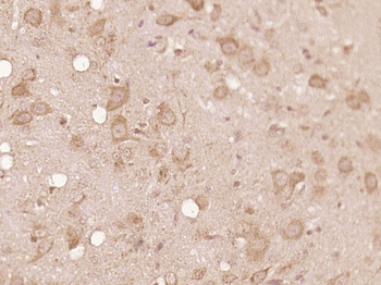 LIMD2 Rabbit Polyclonal Antibody