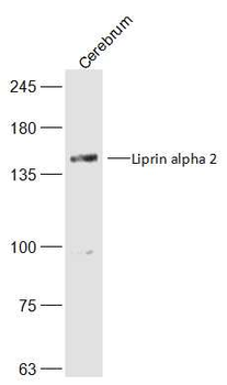 Liprin alpha 2 Rabbit Polyclonal Antibody