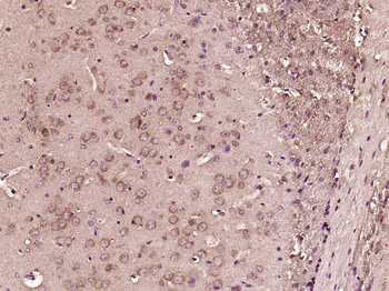 LIX1L Rabbit Polyclonal Antibody