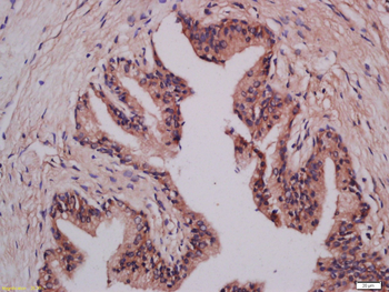 LMAN1 Rabbit Polyclonal Antibody