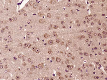 LMBRD1 Rabbit Polyclonal Antibody