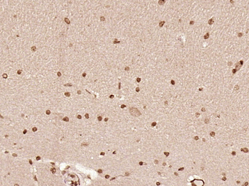 LMO1 Rabbit Polyclonal Antibody