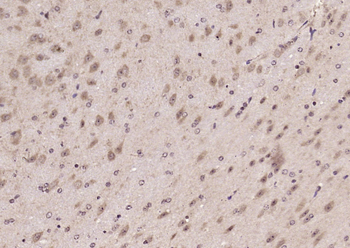 LNX1 Rabbit Polyclonal Antibody