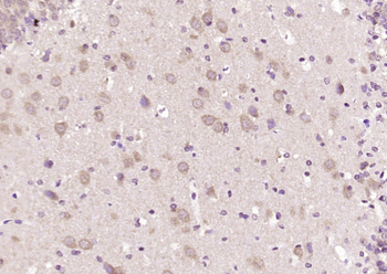 LNX1 Rabbit Polyclonal Antibody
