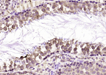 LRGUK Rabbit Polyclonal Antibody