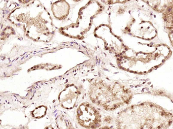 LRRC14 Rabbit Polyclonal Antibody