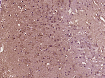 LRRC20 Rabbit Polyclonal Antibody