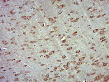 LRRC34 Rabbit Polyclonal Antibody