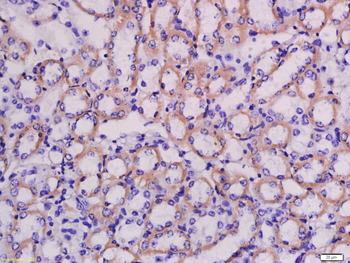 LRRC67 Rabbit Polyclonal Antibody