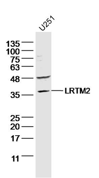 LRTM2 Rabbit Polyclonal Antibody