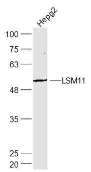 LSM11 Rabbit Polyclonal Antibody