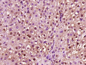 LSMD1 Rabbit Polyclonal Antibody
