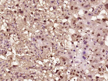 LTV1/C6orf93 Rabbit Polyclonal Antibody