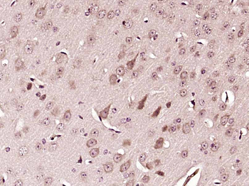 LUZP2 Rabbit Polyclonal Antibody