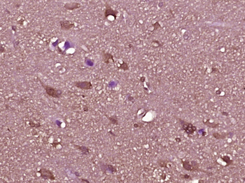 LY6G5C/C6orf20 Rabbit Polyclonal Antibody